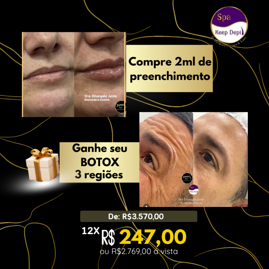 Preenchimento
botox
toxna butolinica
dysport