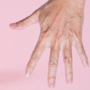 Homem recebendo depilação a laser nas mãos e dedos no Spa Keep Depil no bairro do Limão em São Paulo